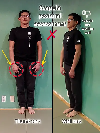 posture-test-protracted-scapula